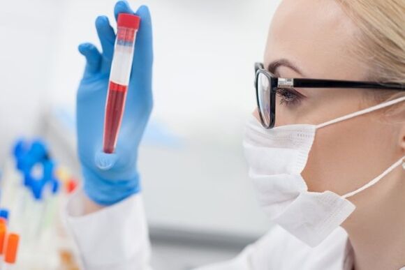 Blutanalyse für Bluthochdruck
